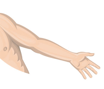 Arm